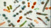 Travelling community have gut microbiome to protect from inflammatory disorders - UCC research