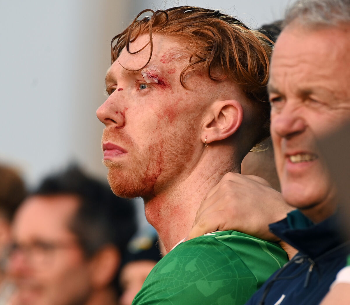 A bloodied and bruised Limerick captain Cian Lynch watching the penalties. Picture: Eddie O'Hare A bloodied and bruised Limerick captain Cian Lynch watching the penalties. Picture: Eddie O'Hare